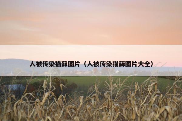 人被传染猫藓图片（人被传染猫藓图片大全）